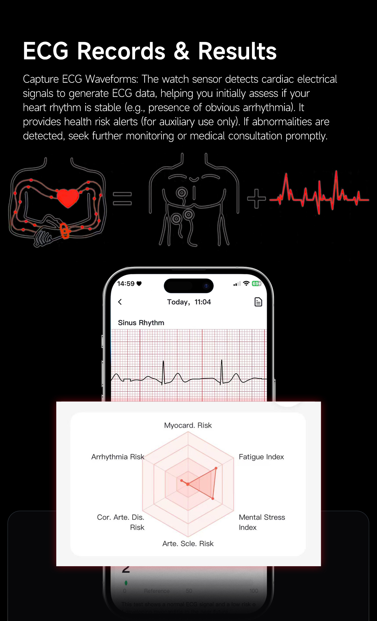 E900 ECG Smart Band