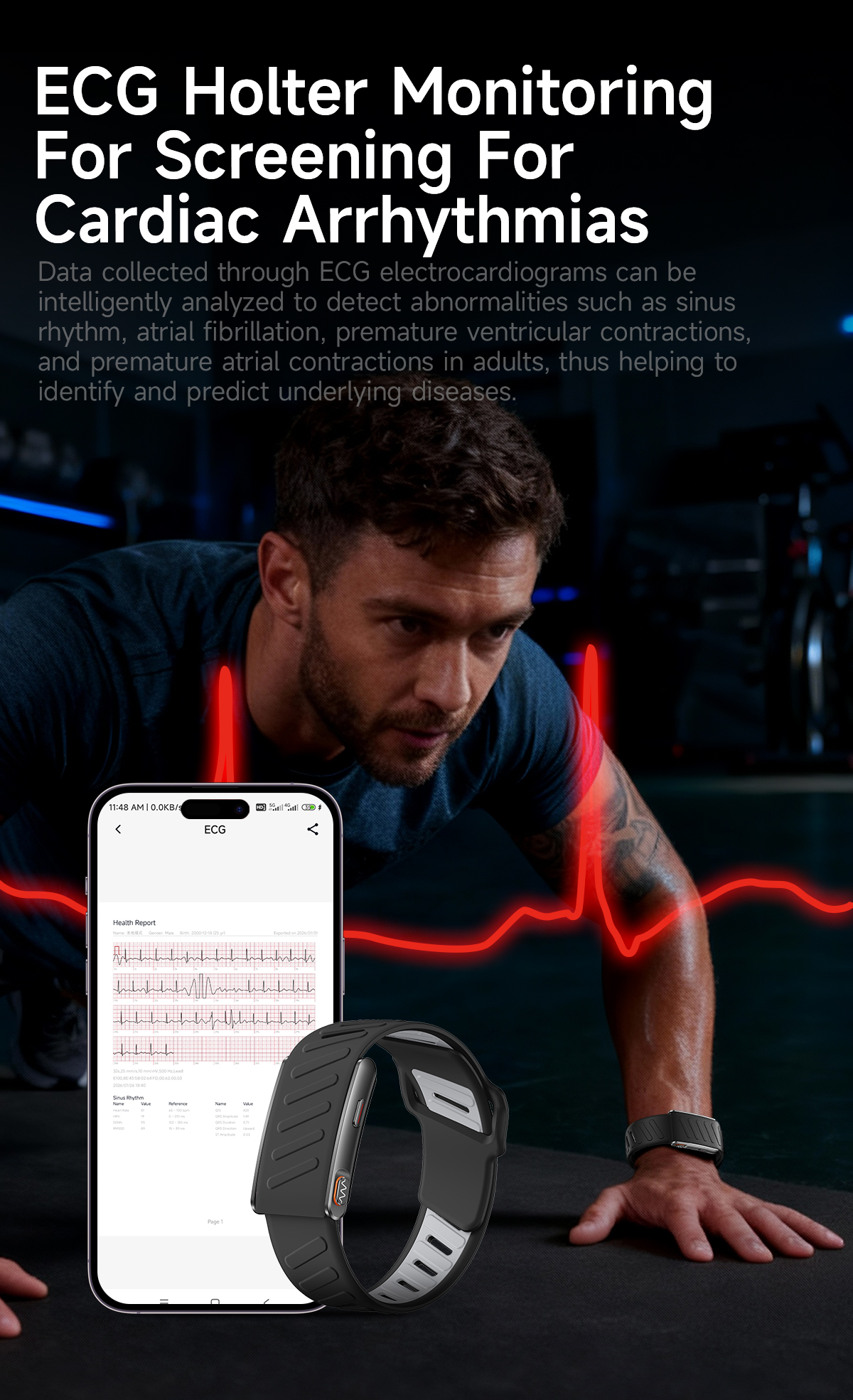 KR96PRO ECG Smart Band